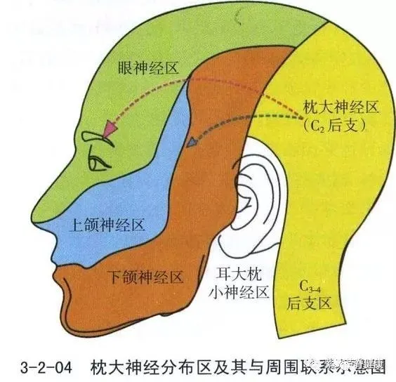 头痛中有90%都是它!根源不在脑袋上,我们该拿它怎么办 - 河北天佑金桥医疗器械有限公司